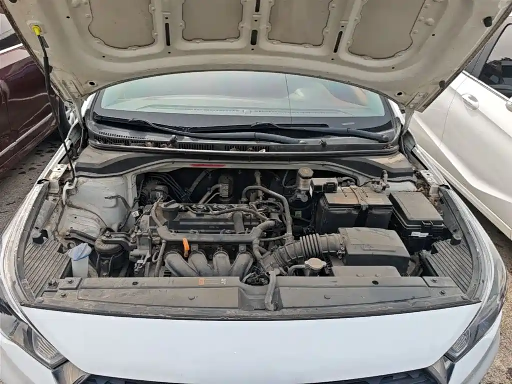 Hyundai Verna RV 2017 1.4L Manual Cool Edition GLS China V фото 16