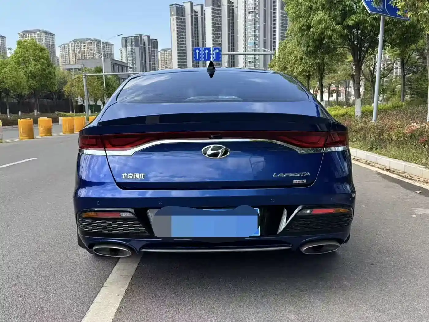 Hyundai Fista 2019 280TGDi Sport Edition China VI фото 5
