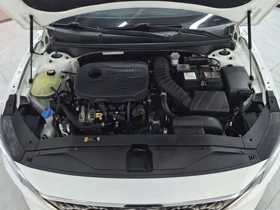 Hyundai Fista 2019 280TGDi Sport Edition China VI фото 10