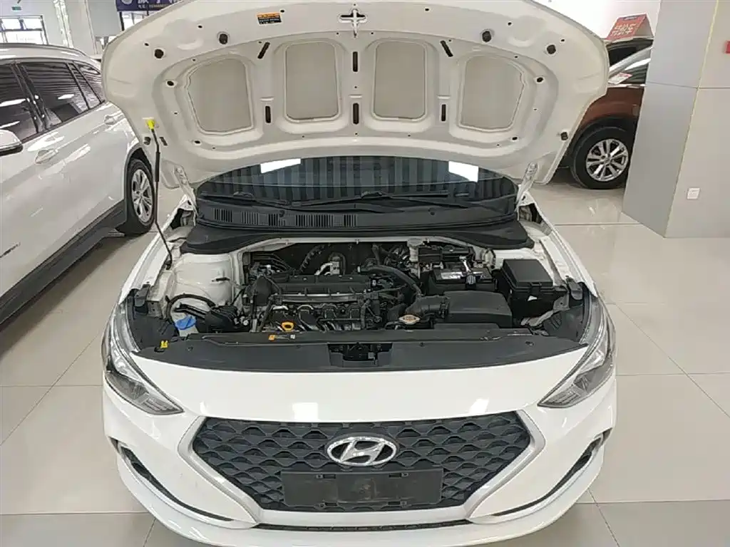 Hyundai Elantra 2018 1.6L Automatic Pleasing Edition GL China VI фото 20