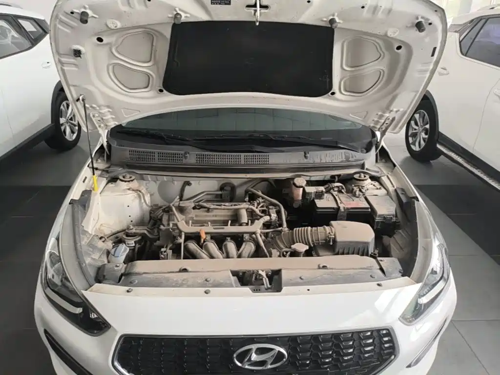 Photo 20 - Hyundai Verna