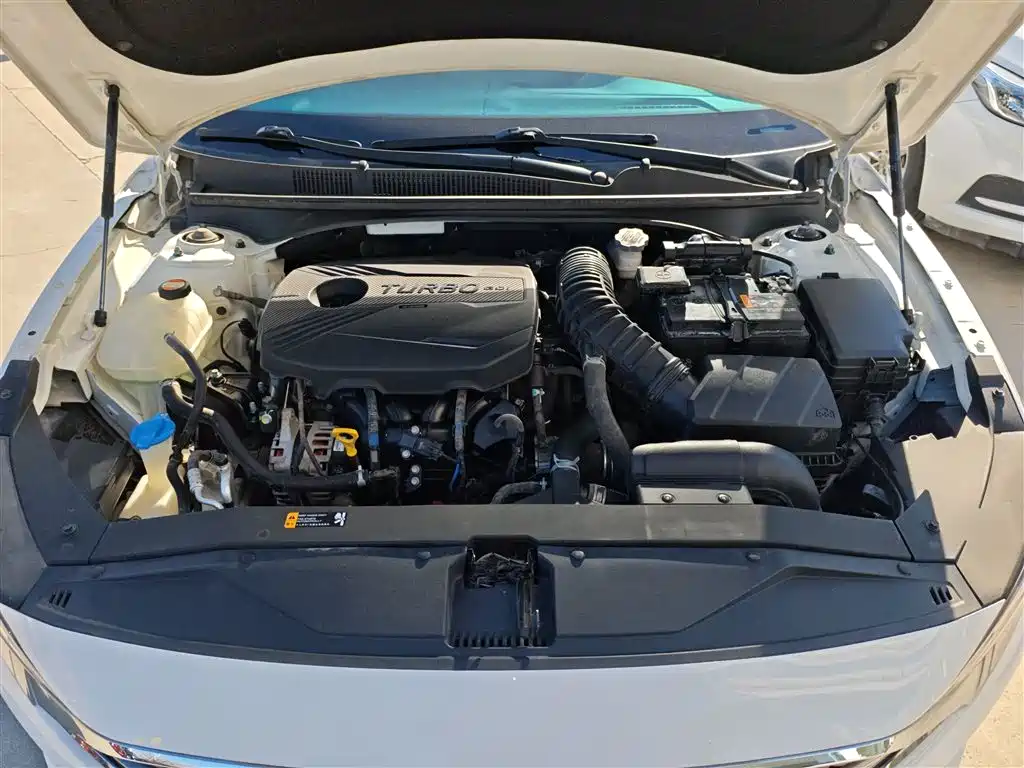 Hyundai Fista 2019 280TGDi Sport Edition China V фото 17